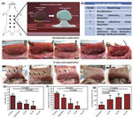Nanoengineered Shear-thinning Hydrogel Barrier for Preventing Postoperative Adhesions Nanoengineered Shear-thinning Hydrogel Barrier for Preventing Postoperative Adhesions