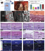 Engineering a highly elastic human protein-based sealant for surgical applications.