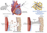 Nanostructured Non-Newtonian Drug Delivery Barrier Prevents Postoperative Intrapericardial Adhesions