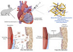 Nanostructured Non-Newtonian Drug Delivery Barrier Prevents Postoperative Intrapericardial Adhesions Nanostructured Non-Newtonian Drug Delivery Barrier Prevents Postoperative Intrapericardial Adhesions